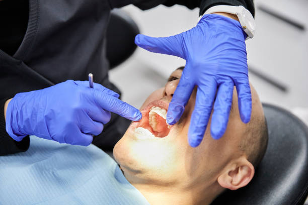Best Emergency Dentist for Lost Fillings or Crowns in Canby, OR